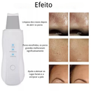 Aparelho de Peeling Esfoliante Ultrassônico Limpeza Facial Profunda Remoção de Cravos Antirrugas Sonic Skin
