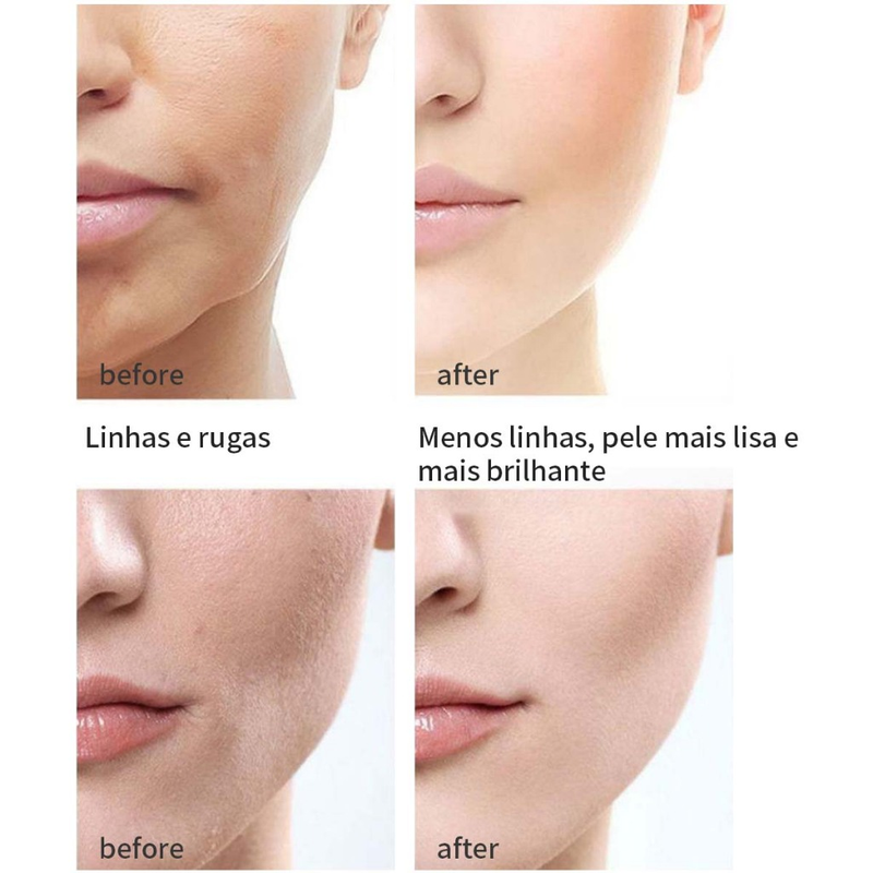 Tecnologia Japonesa 28 Dias Creme Anti-Rugas Rejuvenescedor Da Pele Firmador De Bacalhau retinol creme facial anti idade